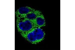 Confocal immunofluorescent analysis of AMACR antibody with HepG2 cells followed by Alexa Fluor 488-conjugated goat anti-rabbit lgG (green).