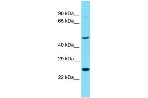 Host: Rabbit Target Name: RTN4RL1 Sample Type: OVCAR-3 Whole Cell lysates Antibody Dilution: 1.