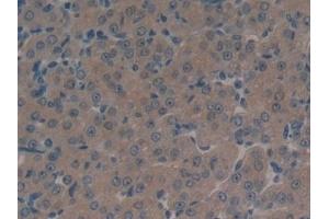 Detection of MRP1 in Human Ovary Tissue using Polyclonal Antibody to Multidrug Resistance Associated Protein 1 (MRP1)