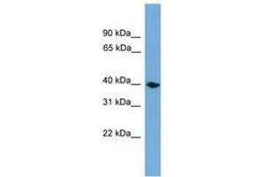 Image no. 1 for anti-Annexin A13 (ANXA13) (AA 151-200) antibody (ABIN6746204) (Annexin A13 anticorps  (AA 151-200))