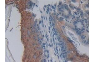 Detection of MPP2 in Mouse Esophagus Tissue using Polyclonal Antibody to Membrane Protein, Palmitoylated 2 (MPP2)