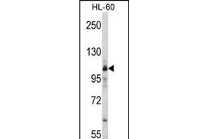 Western blot analysis of RS Antibody (C-term) (ABIN392313 and ABIN2841964) in HL-60 cell line lysates (35 μg/lane). (Mars (MARS) (AA 872-899), (C-Term) anticorps)