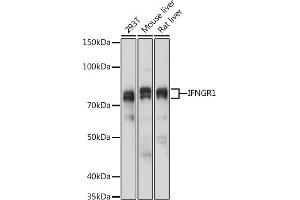 Western blot analysis of extracts of various cell lines, using IFNGR1 antibody (ABIN6127566, ABIN6142197, ABIN6142198 and ABIN6221420) at 1:1000 dilution. (IFNGR1 anticorps  (AA 270-489))