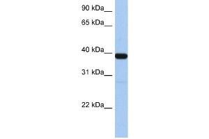 WB Suggested Anti-ZNF781 Antibody Titration:  0. (ZNF781 anticorps  (N-Term))
