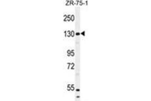 WWC1 Antibody (N-term) western blot analysis in ZR-75-1 cell line lysates (35 µg/lane). (WWC1 anticorps  (N-Term))