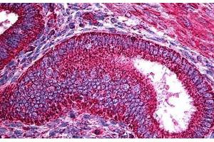 Human Uterus: Formalin-Fixed, Paraffin-Embedded (FFPE)