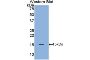Detection of Recombinant ANGPT1, Canine using Polyclonal Antibody to Angiopoietin 1 (ANGPT1)
