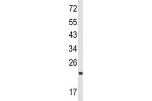 Western blot analysis of RAN antibody and HL-60 lysate.