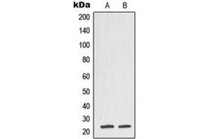 Western blot analysis of TCTP expression in DU145 (A), CCRFCEM (B) whole cell lysates. (TPT1 anticorps  (Center))