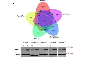 miR-500a-5p directly targets HDAC2 in CRC. (HDAC2 anticorps  (C-Term))