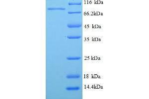 SDS-PAGE (SDS) image for phosphoenolpyruvate Carboxykinase 1 (Soluble) (PCK1) (AA 1-622), (full length) protein (His tag) (ABIN5710071) (PCK1 Protein (AA 1-622, full length) (His tag))