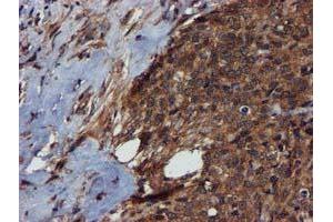 Immunohistochemistry (IHC) image for anti-Complement Component 1, S Subcomponent (C1S) antibody (ABIN1497565) (C1S anticorps)