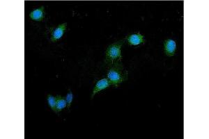 IF analysis of GRK2 using anti-GRK2 antibody (ABIN7602826). (GRK2 anticorps  (C-Term))