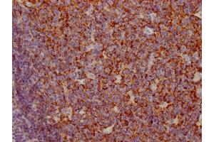 IHC image of ABIN7127401 diluted at 1:100 and staining in paraffin-embedded human tonsil tissue performed on a Leica BondTM system. (Recombinant CD35 anticorps)