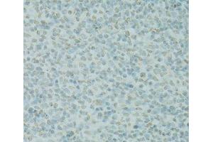 Immunohistochemistry of paraffin-embedded Rat spleen using SAFB Polyclonal Antibody at dilution of 1:100 (40x lens).