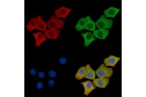 Cathepsin D Mouse Monoclonal Antibody staining HepG2 cells by IF/ICC. (Cathepsin D anticorps  (C-Term))