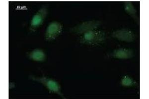 Immunostaining analysis in HeLa cells. (EIF4ENIF1 anticorps)