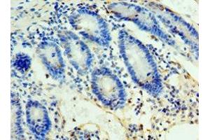 Immunohistochemistry of paraffin-embedded human duodenum tissue using ABIN7161653 at dilution of 1:100 (ULBP2 anticorps  (AA 26-216))
