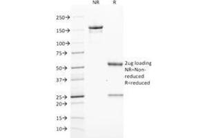 SDS-PAGE Analysis Purified ZAP70 Mouse Monoclonal Antibody (ZAP70/2046). (ZAP70 anticorps  (AA 247-382))