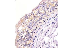 Paraformaldehyde-fixed, paraffin embedded human bladder tissue, Antigen retrieval by boiling in sodium citrate buffer (pH6. (BID anticorps)