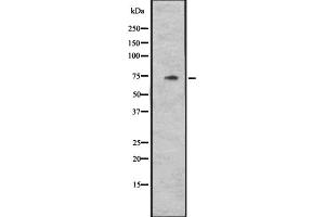 Western blot analysis of CYLC1 expression in Hela cell lysate,The lane on the left is treated with the antigen-specific peptide. (CYLC1 anticorps)
