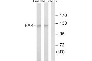 Western blot analysis of extracts from HUVEC cells and MCF-7 cells, using FAK (epitope around residue 843) antibody. (FAK anticorps)