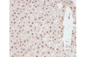 Immunohistochemistry of paraffin-embedded Rat liver using Phospho-PRKAA1(T183)/PRKAA2(T172) Polyclonal Antibody at dilution of 1:100 (40x lens).