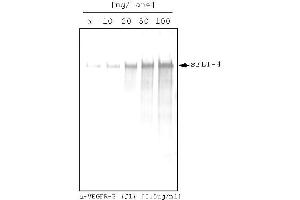 Western analysis (AP) using recombinant human soluble VEGFR-3/FLT-4 as target!