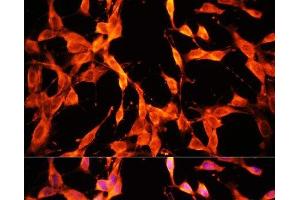 Immunofluorescence analysis of NIH/3T3 cells using MST1 Polyclonal Antibody at dilution of 1:100. (MST1 anticorps)