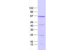 Validation with Western Blot (ZNF354A Protein (His tag))