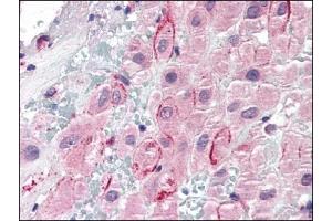 Image no. 1 for anti-Secreted phosphoprotein 1 (SPP1) (C-Term) antibody (ABIN372777) (Osteopontin anticorps  (C-Term))
