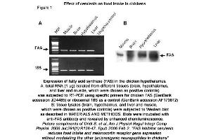 Image no. 1 for anti-Fatty Acid Synthase (FASN) (N-Term) antibody (ABIN363338) (Fatty Acid Synthase anticorps  (N-Term))