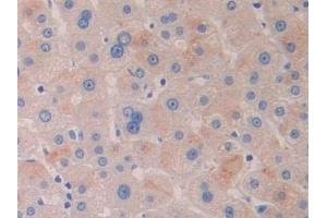 Detection of HDAC6 in Human Liver Tissue using Polyclonal Antibody to Histone Deacetylase 6 (HDAC6)