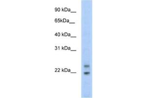 Western Blotting (WB) image for anti-Cytoplasmic Polyadenylated Homeobox (CPHX) antibody (ABIN2461548) (CPHX anticorps)