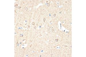 Immunohistochemistry of paraffin-embedded human brain using Guanylyl Cyclase beta 1 (GUCY1B3) (GUCY1B3) Rabbit mAb (ABIN7267551) at dilution of 1:100 (40x lens).