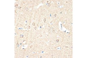 Immunohistochemistry of paraffin-embedded human brain using Guanylyl Cyclase beta 1 (GUCY1B3) (GUCY1B3) Rabbit mAb (ABIN7267551) at dilution of 1:100 (40x lens). (GUCY1B3 anticorps)