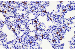 Immunohistochemistry of paraffin-embedded Mouse lung using S100a8 Polycloanl Antibody at dilution of 1:200 (S100A8 anticorps)