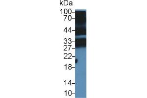 Detection of PGLYRP1 in Mouse Thymus lysate using Polyclonal Antibody to Peptidoglycan Recognition Protein 1 (PGLYRP1) (PGLYRP1 anticorps  (AA 19-182))