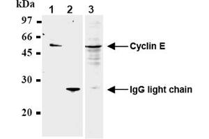 Western Blotting (WB) image for anti-Cyclin E1 (CCNE1) antibody (ABIN567784) (Cyclin E1 anticorps)