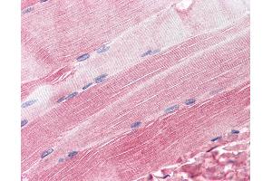 Anti-RAPSN / RAPSYN antibody IHC of human skeletal muscle. (RAPSN anticorps  (AA 395-412))