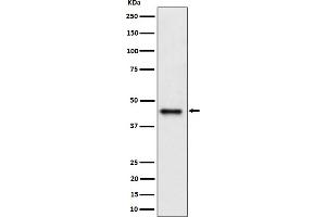 Western blot analysis of DAZAP1 expression in Jurkat cell lysate.