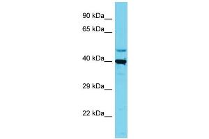 Host: Rabbit Target Name: SLC35E1 Sample Type: HepG2 Whole Cell lysates Antibody Dilution: 1. (SLC35E1 anticorps  (C-Term))