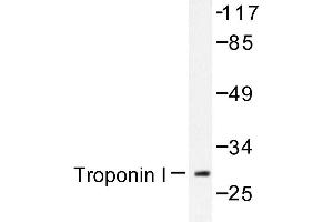 Image no. 1 for anti-Cardiac Troponin I (TNNI3) antibody (ABIN272087) (TNNI3 anticorps)