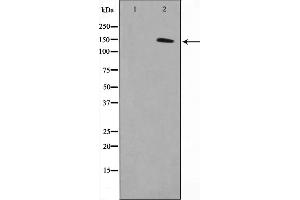 Western blot analysis on COLO205 cell lysate using MN1 Antibody,The lane on the left is treated with the antigen-specific peptide. (Meningioma 1 anticorps  (Internal Region))