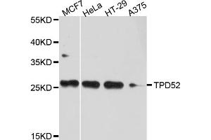 Western blot analysis of extracts of various cell lines, using TPD52 antibody. (TPD52 anticorps)