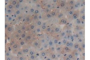 Detection of GSTA4 in Rat Liver Tissue using Polyclonal Antibody to Glutathione S Transferase A4 (GSTA4)