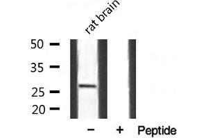 Western blot analysis of extracts from mouse Brian, using SPIC antibody.