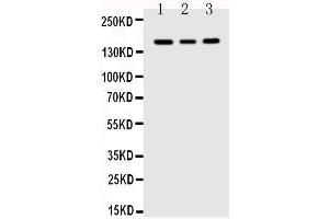 Anti-VEGF Receptor 1 antibody, Western blotting Lane 1: MCF-7 Cell Lysate Lane 2: SGC Cell Lysate Lane 3: MM231 Cell Lysate