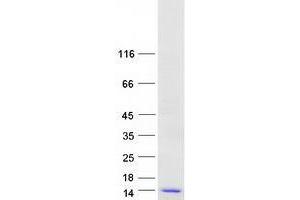 Validation with Western Blot