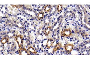 Detection of KRT6A in Rat Kidney Tissue using Polyclonal Antibody to Keratin 6A (KRT6A)
